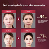 LED Vibration Facial Massager & Slimming Device