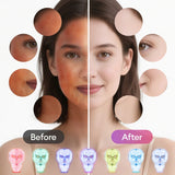 7-Color LED Face Neck Mask